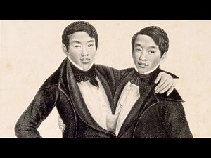 The Incredible Life of the Famous Siamese Twins