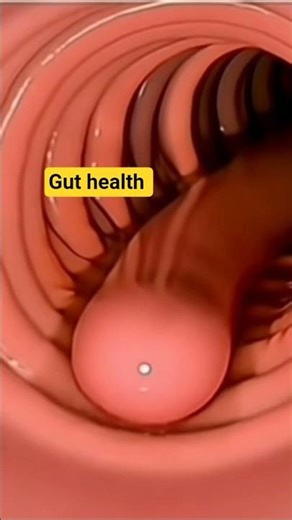 Struggling with Bloating? Gut Health & Intestinal Problems Explained in 3D #intestinal #gutfriendly