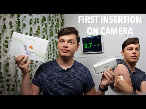 DEXCOM G6 Unboxing & First Insertion -Step by step Dexcom G6 Insertion