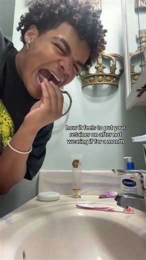 How it feels to put retainers on after not wearing them?