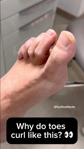 Why Do Toes Curl Like This? 👀