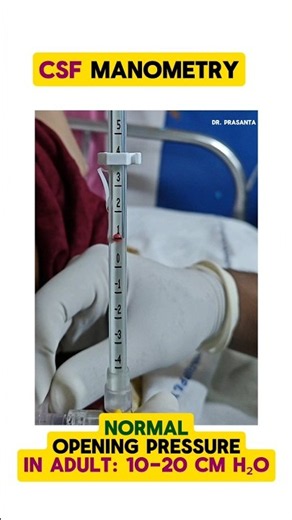CSF Manometry | Lumber Puncture #neurology #drprasanta #csf