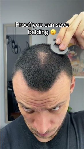 Can be saved easily. Just use Rooty 🤭