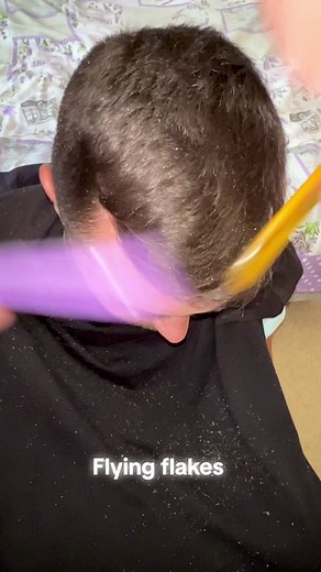 Effective Treatments for Dry Scalp and Skin