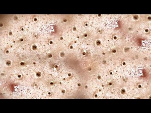 Fascinating Your Day with Thuy Dung Spa Videos #86