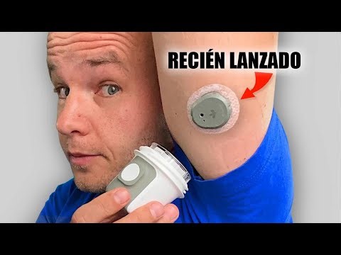 Probé el Stelo CGM, ¿vale la pena?