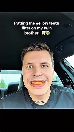 Yellow Teeth Filter… Their Reaction Was Wild!#yellowteethfilter#yellowteethprank#filterprank