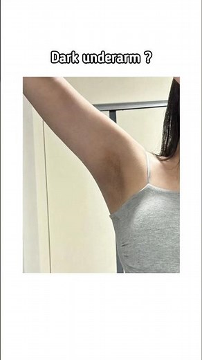 fix Dark Underarms & Tanned Skin at home!✨🍓 #skincare #beautytips #glowingskin #fypシ #shorts