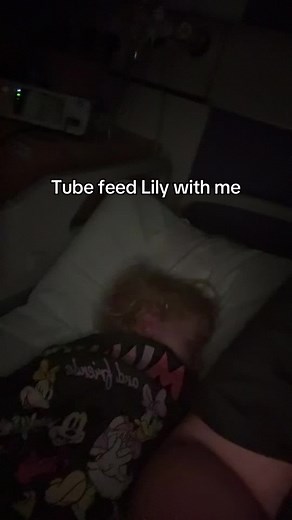 Tube Feeding Tutorial for Keeping Lily Hydrated