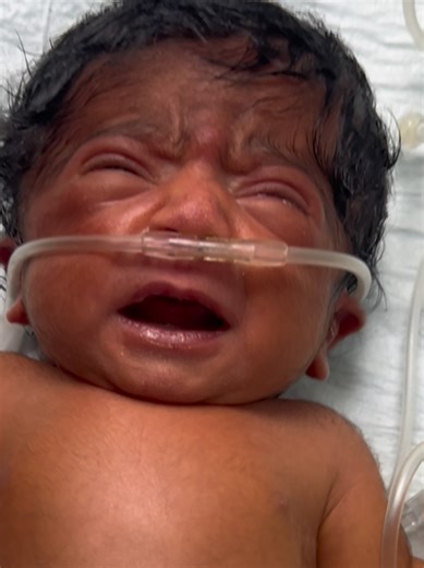 Different from another baby #unfreezemyaccount #usa🇺🇸 #newborn #crybaby