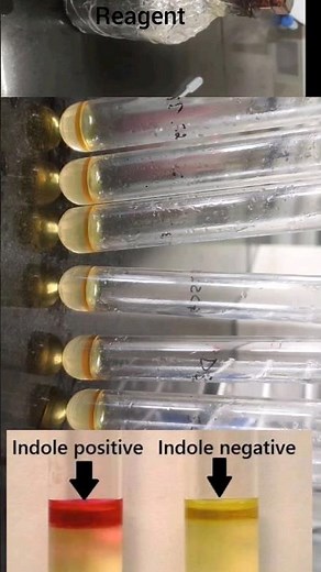 #Indole Test #biochemical test #microbiology
