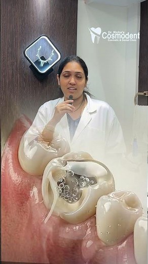 Let's see how a root canal treatment is done.