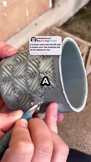 Emergency Room Visit: A Woman's Broken Arm Story