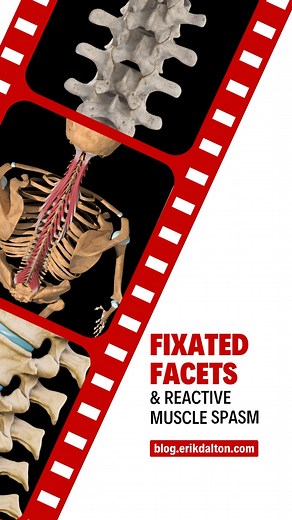 3.7K views · 28 reactions | Fixated Facets & Reactive Muscle Spasm...