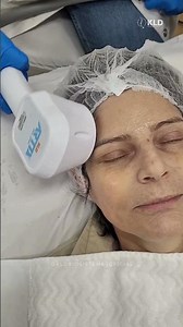 Definição facial com tecnologia e precisão - Artix