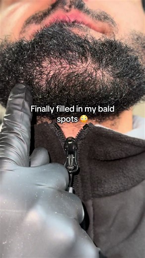 Discover Hair Growth Benefits of Bebodywise Serum