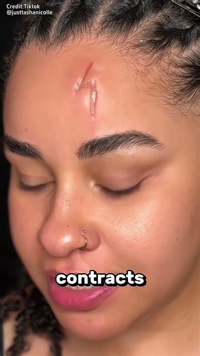 The Science Behind Realistic Fake Scars😲