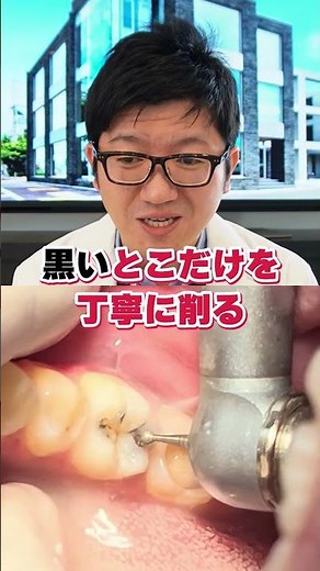 The doctor explained the treatment of drilling away the decayed tooth and reconstructing it!