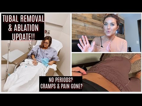 TUBAL REMOVAL & ABLATION UPDATE | POST SURGERY |