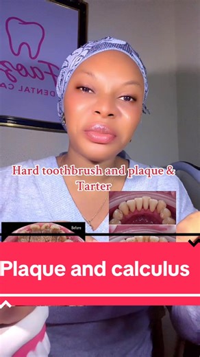 Effective Toothbrush Techniques for Plaque Removal