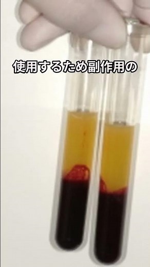再生医療の最前線『CGF』とは？歯科だけじゃない幅広い活用例と驚きの効果 #再生医療 #CGF #インプラント