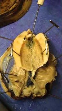 Clam dissection