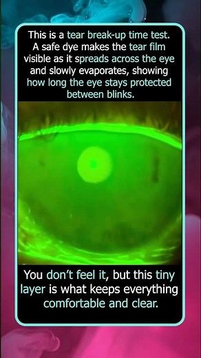 What Happens to Your Eyes Between Blinks