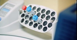 scientist puts virus samples into machine at biotechnology molecular laboratory.