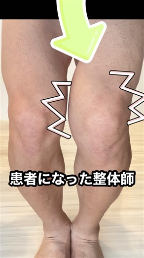 膝をぶっ壊してきた整体師の自己再生記録・エピソード0。全治約3ヶ月を自分で治す（人体実験）