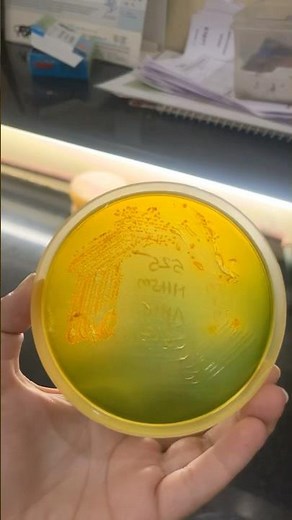 Vibrio cholera (rice watery stools) colonies on TCBS and blood agar #cool #science #vibrio #cholera