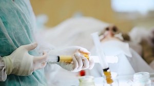 Filtration Pumping Fat Lipofilling Cosmetic Surgery Stock Footage Video (100% Royalty-free) 1063117753 | Shutterstock