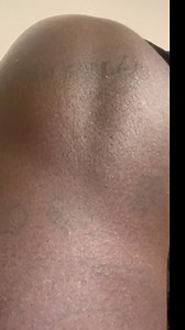 This been going with my muscles for 2 years painful 😣 | Covision videos