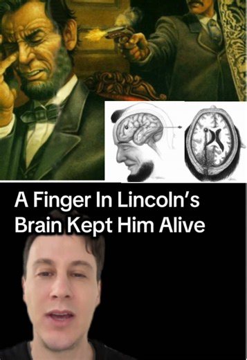 A doctor placed his finger into Abraham Lincoln’s brain after the assassination to keep him alive. It sounds unbelievable, but it helped him keep breathing and stay alive for 9 additional hours. Medical care in the 1800s was very different from today, and this moment became one of the strangest stories in medical history. Did you know this about Lincoln? Do you think he would have survived today with modern neurosurgical care and technology. #abrahamlincoln #historyfacts #learnontiktok #ushistor