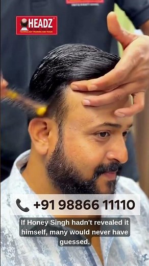 From Completely Bald to Full Hair | Hair System Transformation #honeysingh #hairwig #hairstyle
