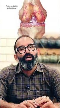 knee lock treatment l Knee Lock Explained | Causes, Symptoms & Quick Relief Tips#shorts