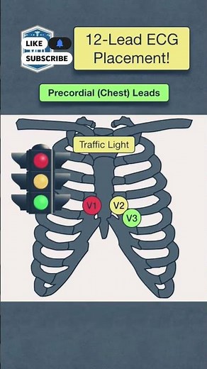 Master 12 Lead EKG Placement FAST | Color Memory Trick for Nurses