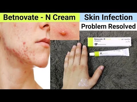 Betnovate N Cream Review - Benefits & Uses | Betnovate N Cream for Face Acne Pimples