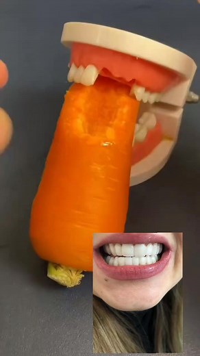 moldablep false teeth #partager_max_svp | Ferial