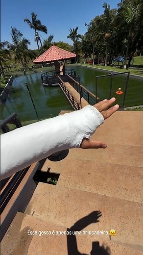 Renato Garcia Não Quebrou o Braço #renatogarciayt #shorts #blackstone #viral