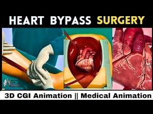 Heart bypass surgery || 3D CGI Animation || Medical Animation : BiologywithAliya