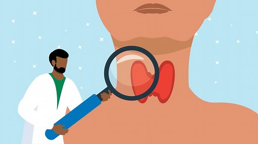 Hypothyroidism vs. Hyperthyroidism