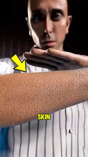 What Actually Causes Goosebumps?