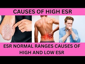 ESR IS HIGH HOW TO REDUCE IT?CAUSES OF HIGH ESR.WHAT CAUSES LOW ESR?ESR NORMAL RANGES,ESR BLOOD TEST