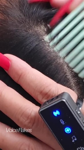 Extreme Dry Scalp Surge: Deep Scratching & Massive Flake Release ASMR