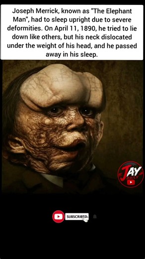 💔 He Just Wanted to Sleep… The Tragic Story of Joseph Merrick | “The Elephant Man”