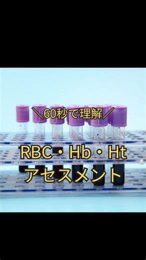 かりんとうナース/ICUナースの実務で使える看護知識 | 過去投稿はコチラ⇛@karinto_nurse RBC・Hb・Ht値のアセスメントについてまとめました！ 検査データ:看護rooより引用 ※動画時間の関係上、情報全てをお伝えすることはできません。ご了承ください 個人的見解もあります。 かりんとうナース... | Instagram