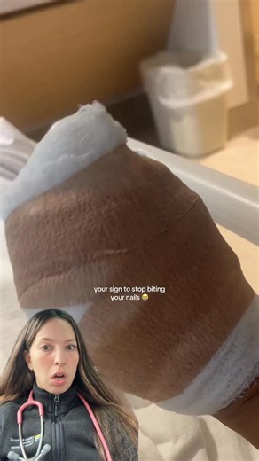 Dr. Jess on Instagram: "Dangers of picking your cuticules or biting your nails Key Reasons to Stop Biting Your Nails: Infections (Paronychia): Nail biting causes microscopic tears in the skin, allowing bacteria to enter, which can result in infections, swelling, and pus-filled sores around the nail. Viral Infections: It can lead to warts, particularly in the nail area or on the lips, which are difficult to treat. Dental Issues: Constant pressure and grinding can damage tooth enamel, crack or chi