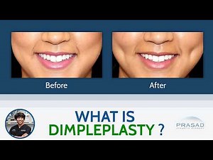 Dimpleplasty: Dimple Surgery Explained by Cosmetic Surgeon