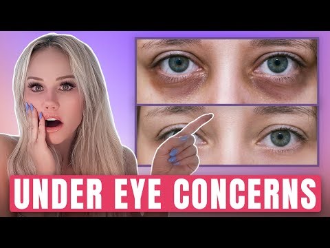 Looking Tired? Ask a Doctor! FREE Consultation - Live Q&A