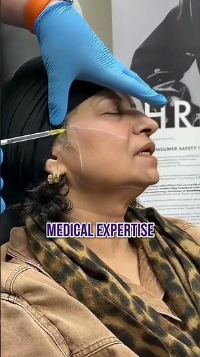 This is your sign to get PDO thread lifts ✨